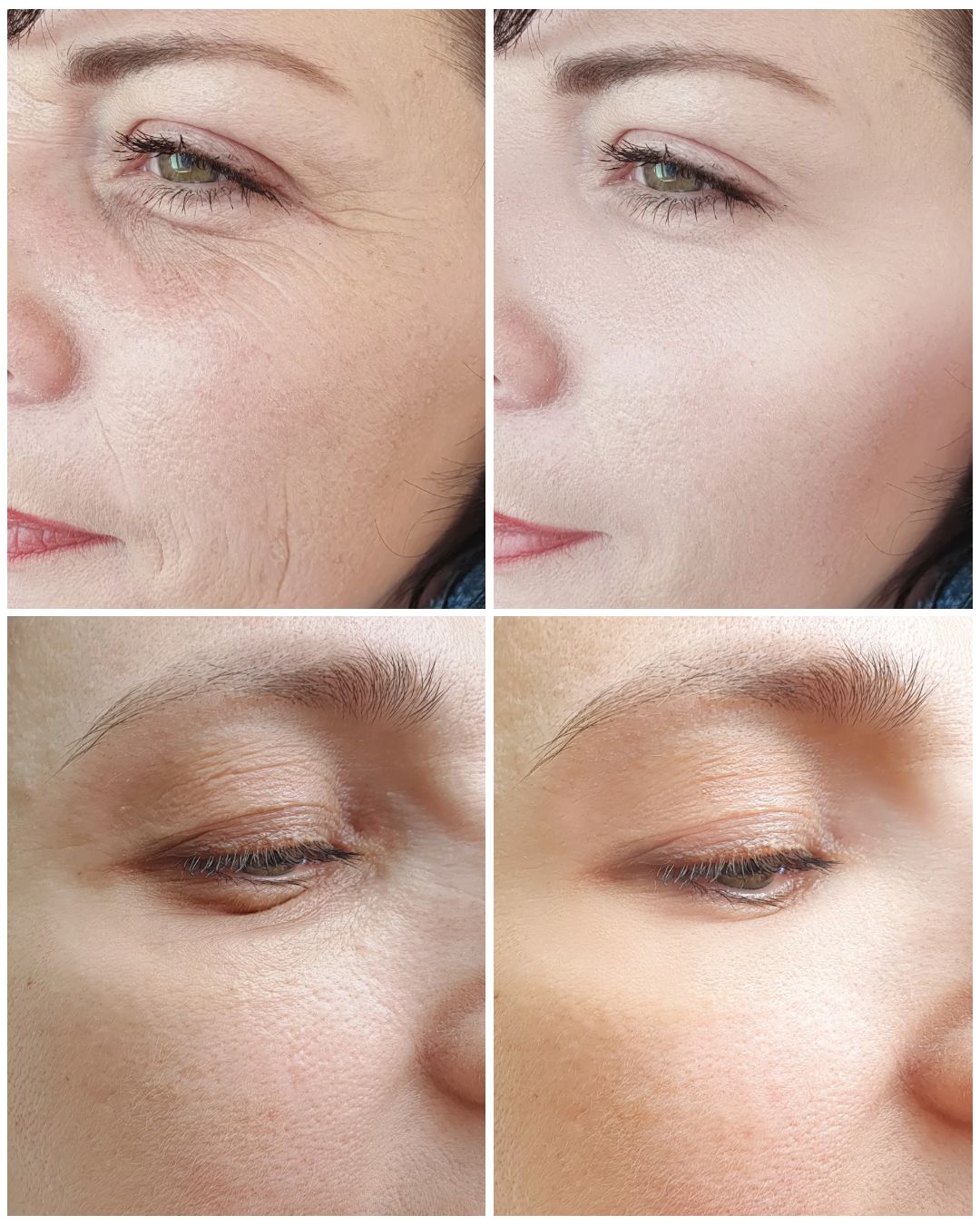 Pro-Active Gel Cleanser