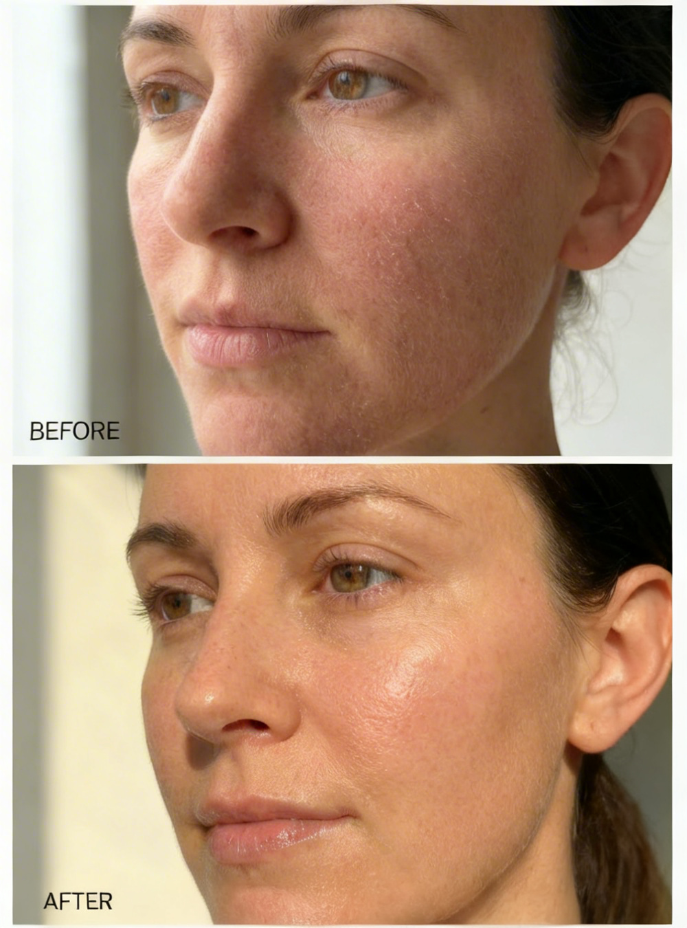 Pro-Active Gel Cleanser