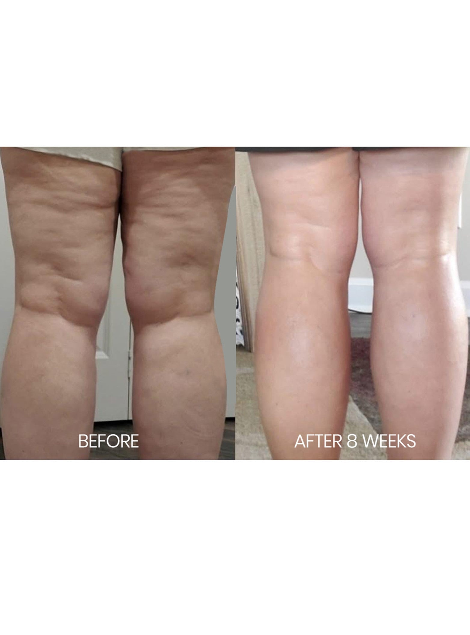 Firm & Fade Cellulite Eraser – Smooth, Toned & Hydrated Look – Celesty