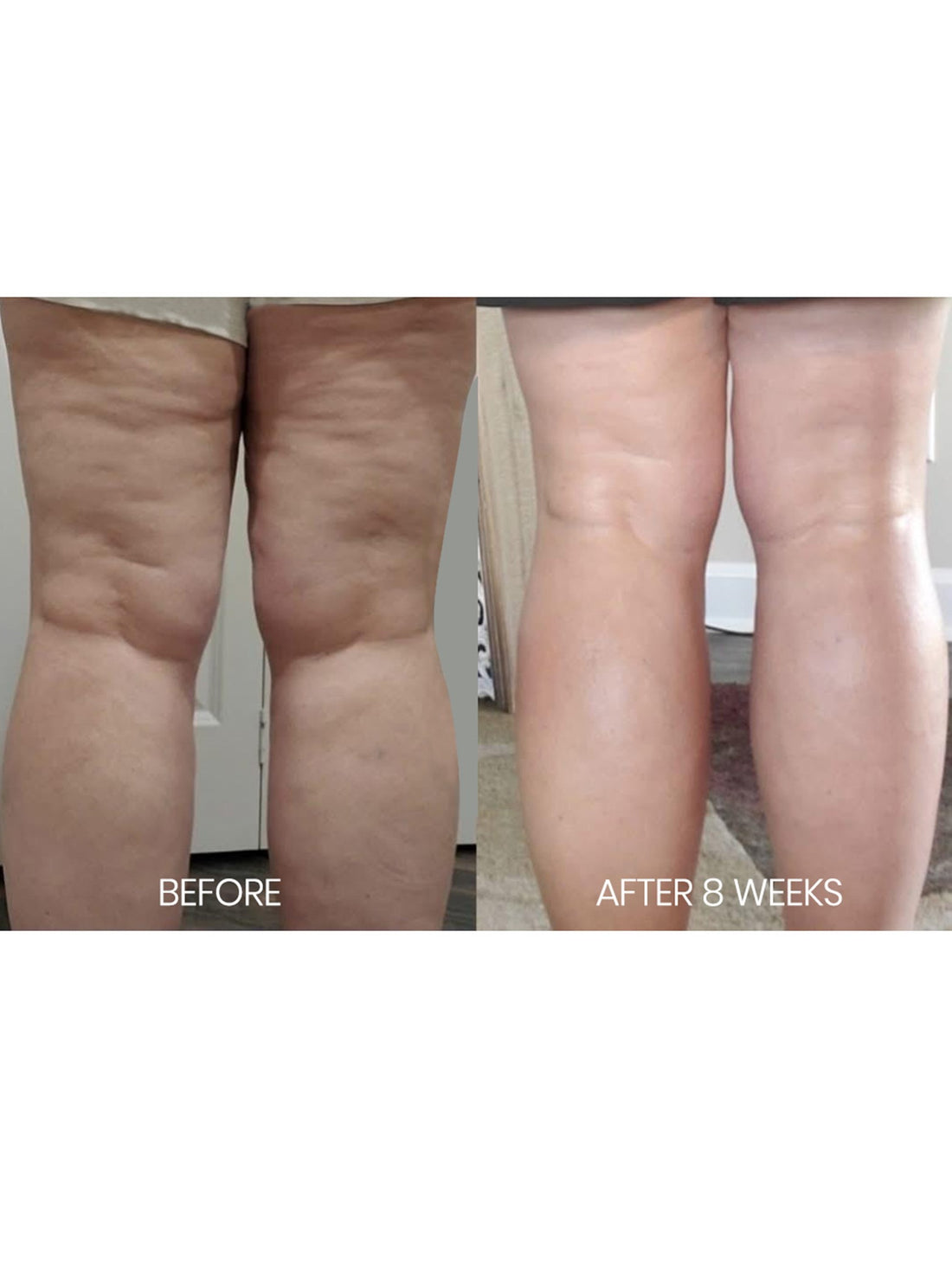 Firm & Fade Cellulite Eraser