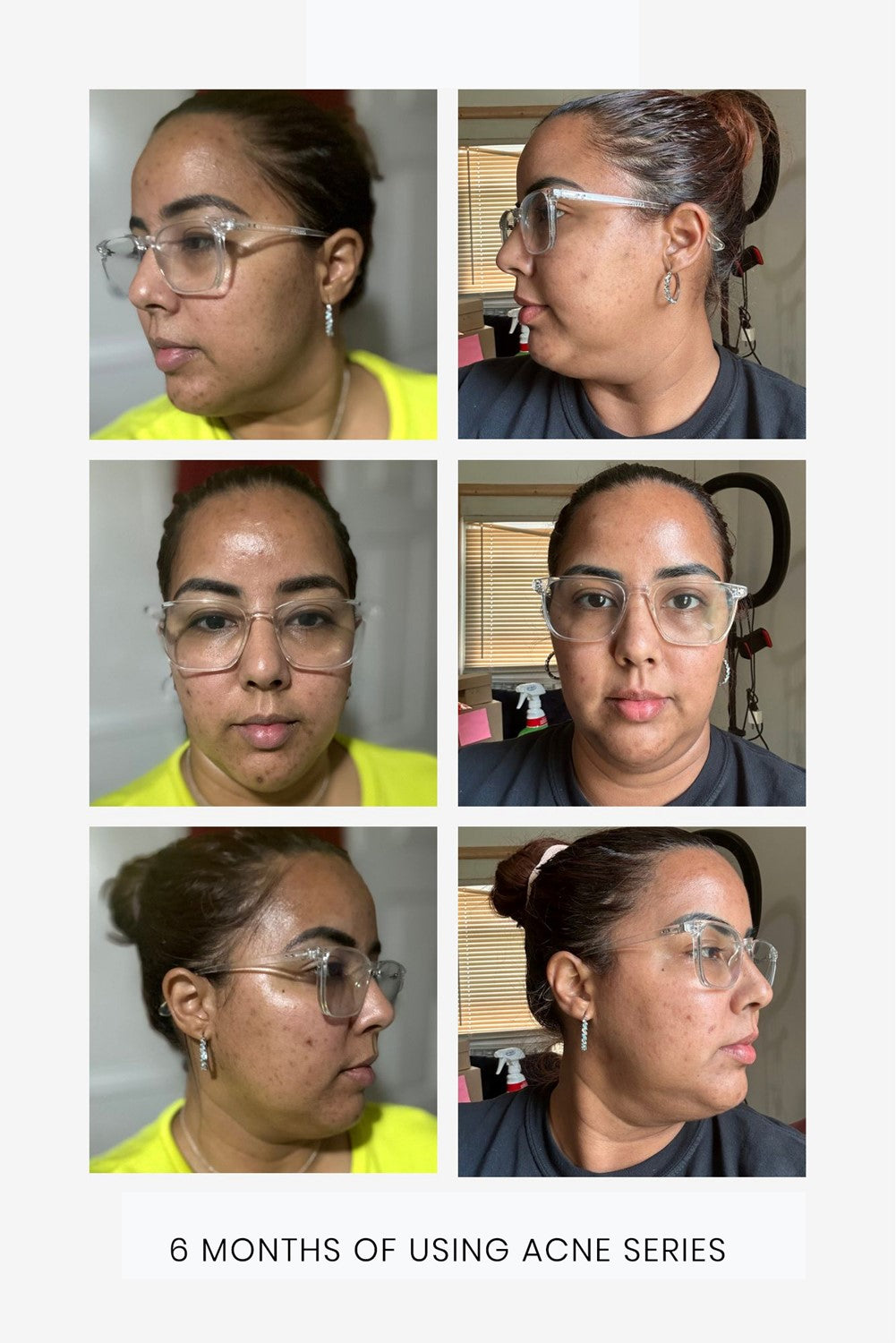 Deep Cleansing Gel