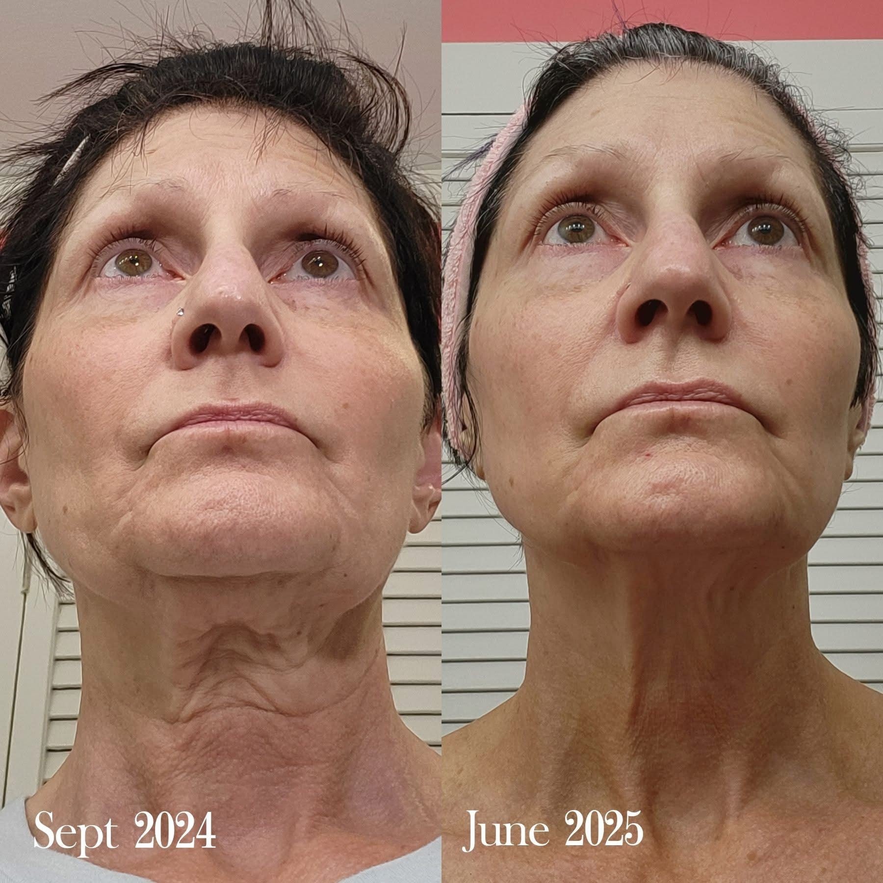 Stem Cell Eye Lifting Cream
