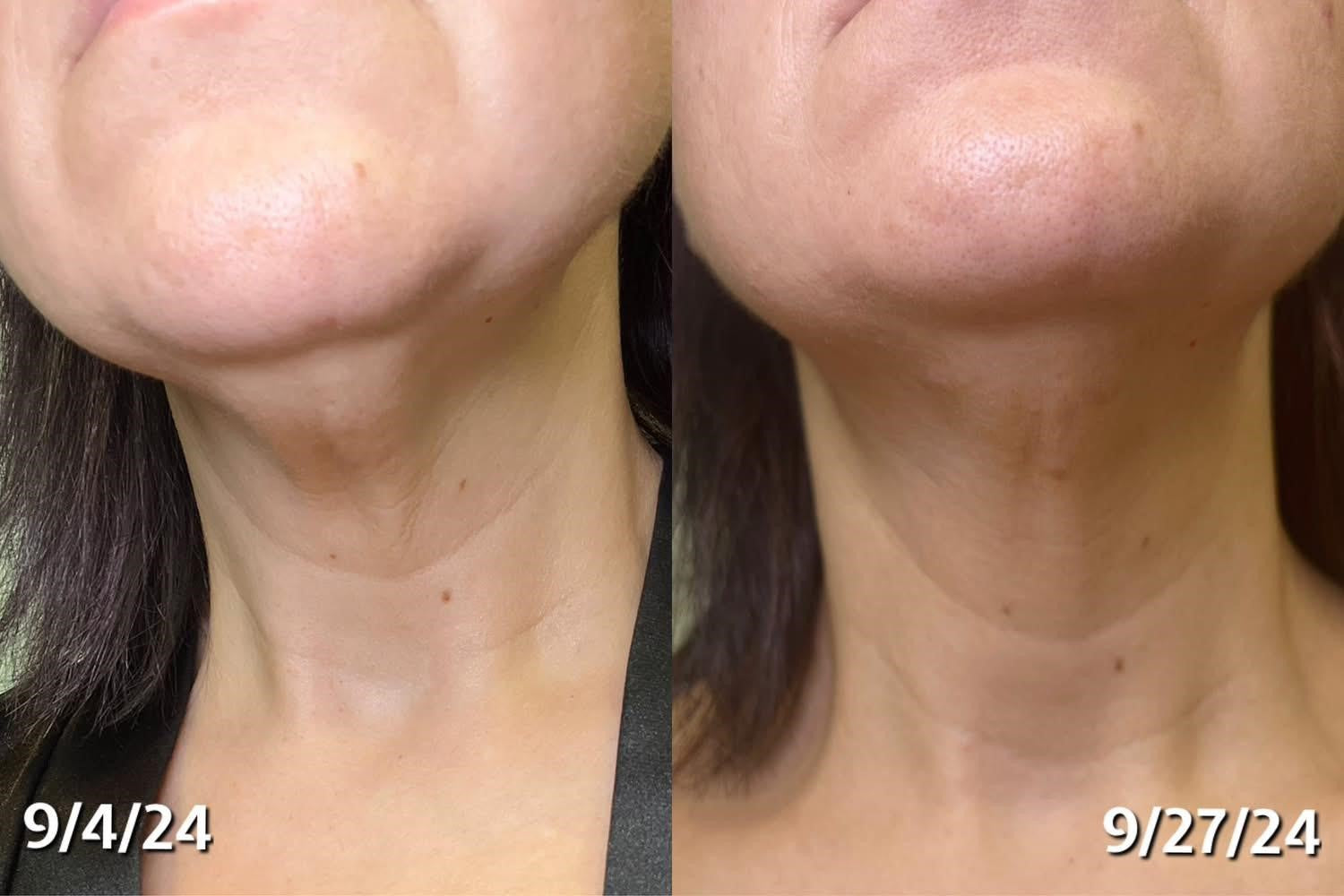 Cell Regen Growth Factor Serum