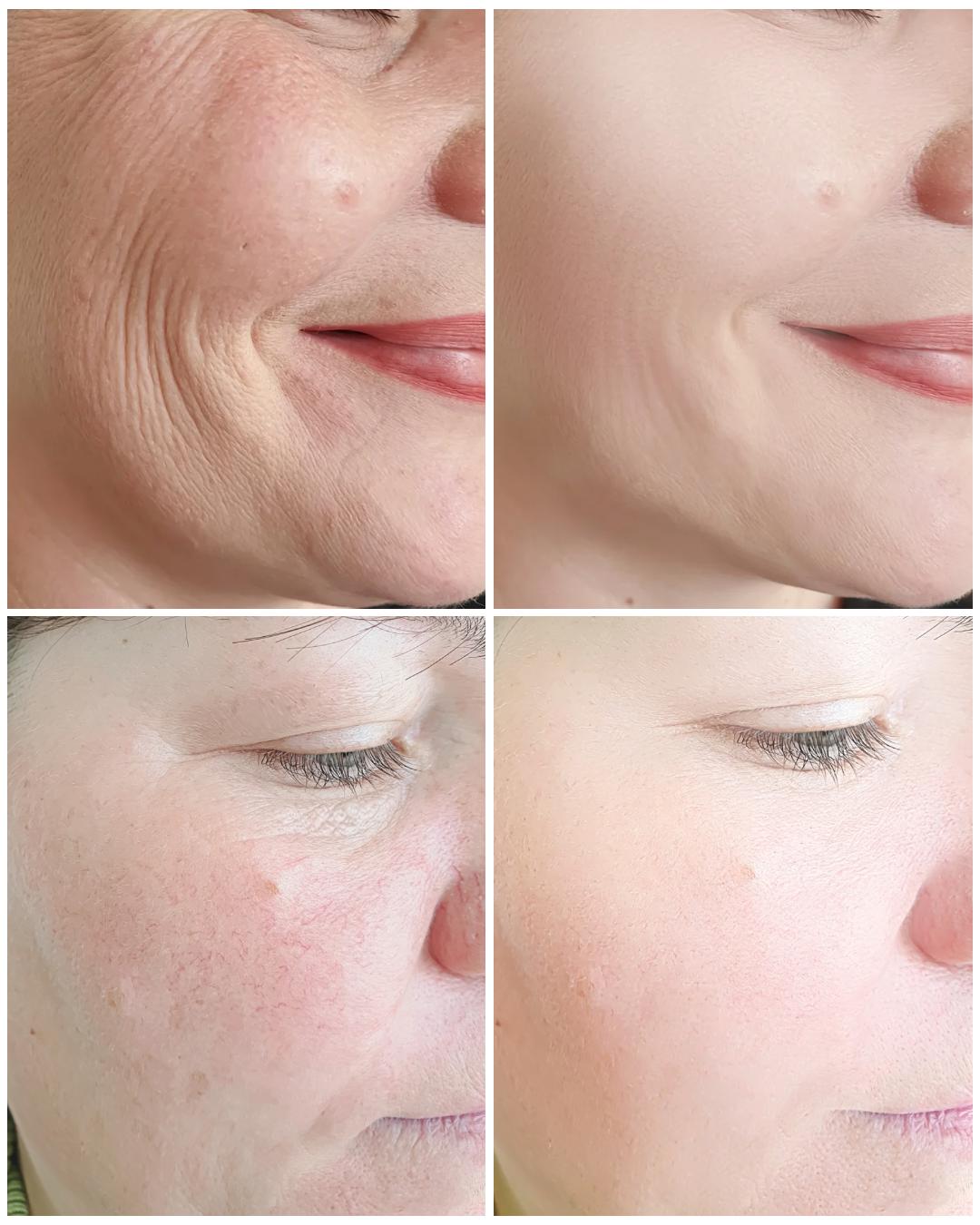 Hydra Firm Elasticity Boost Serum