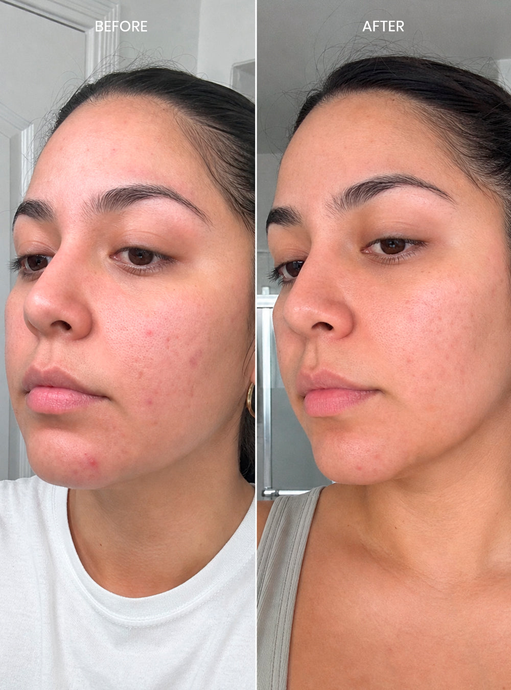 Clear Skin Solution