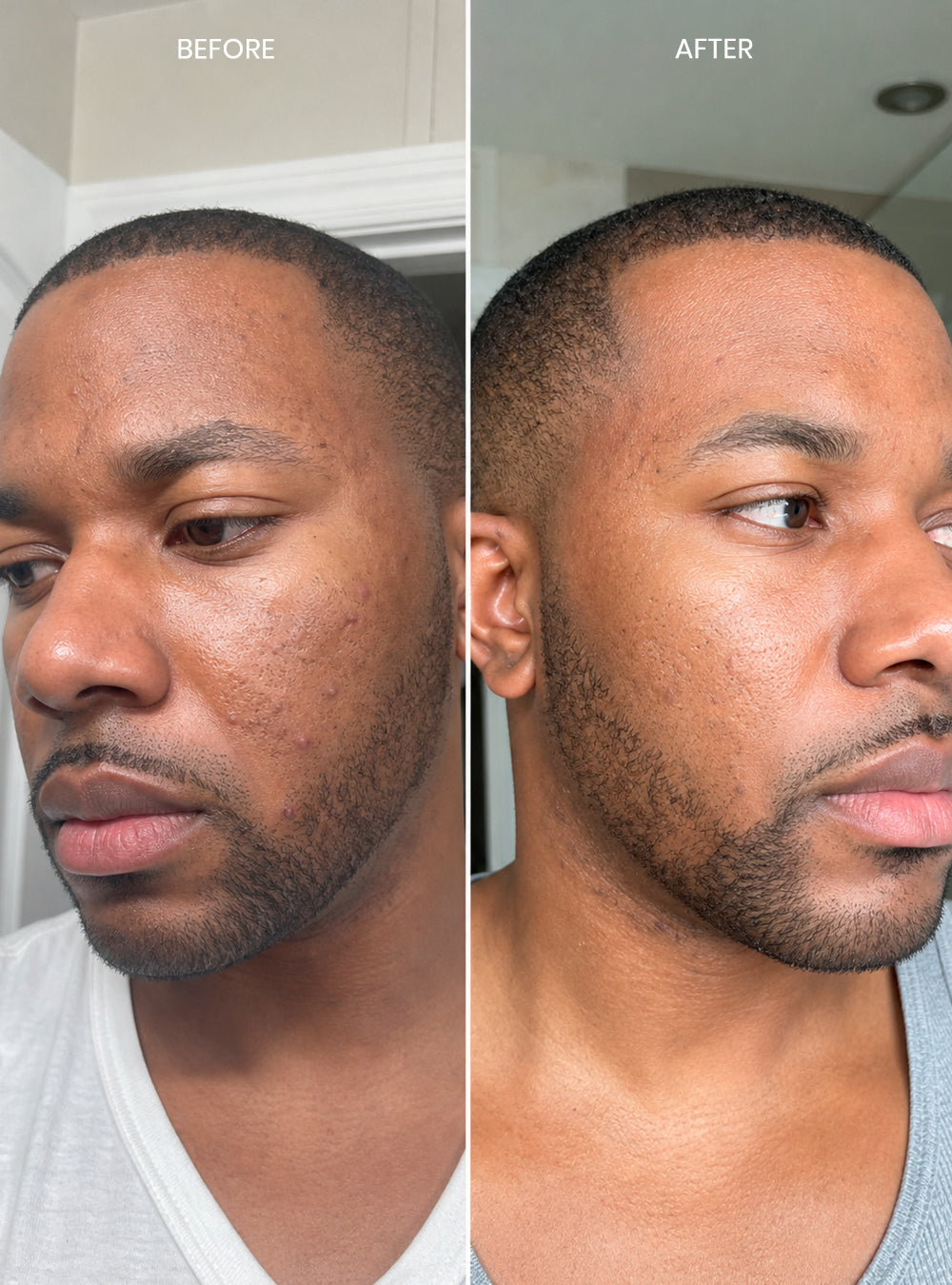 Clear Skin Solution