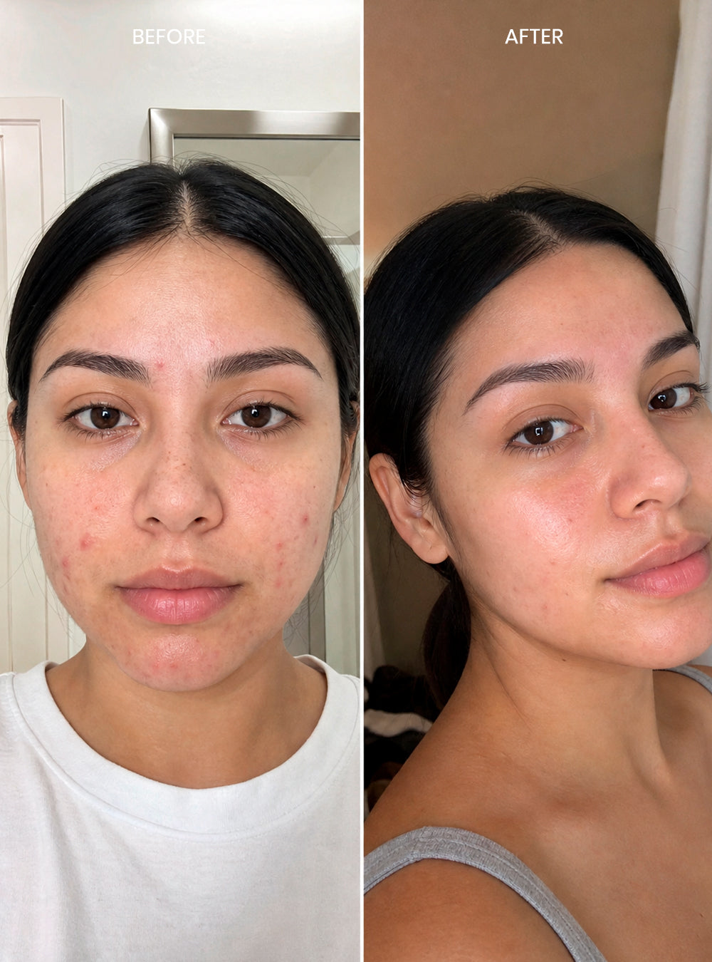 Clear Skin Solution