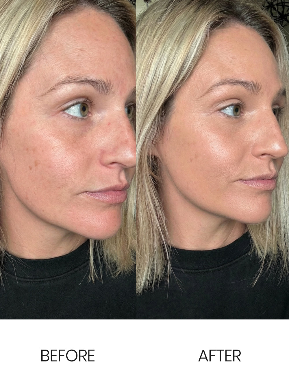 BB Cream - Hydrating & SPF 25 Formula for Smooth, Even Skin – Celesty