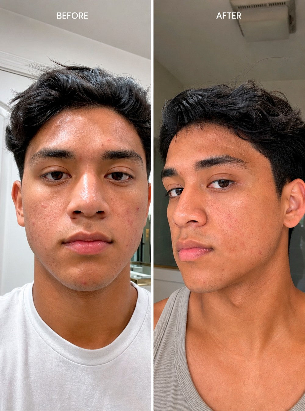 Deep Cleansing Gel