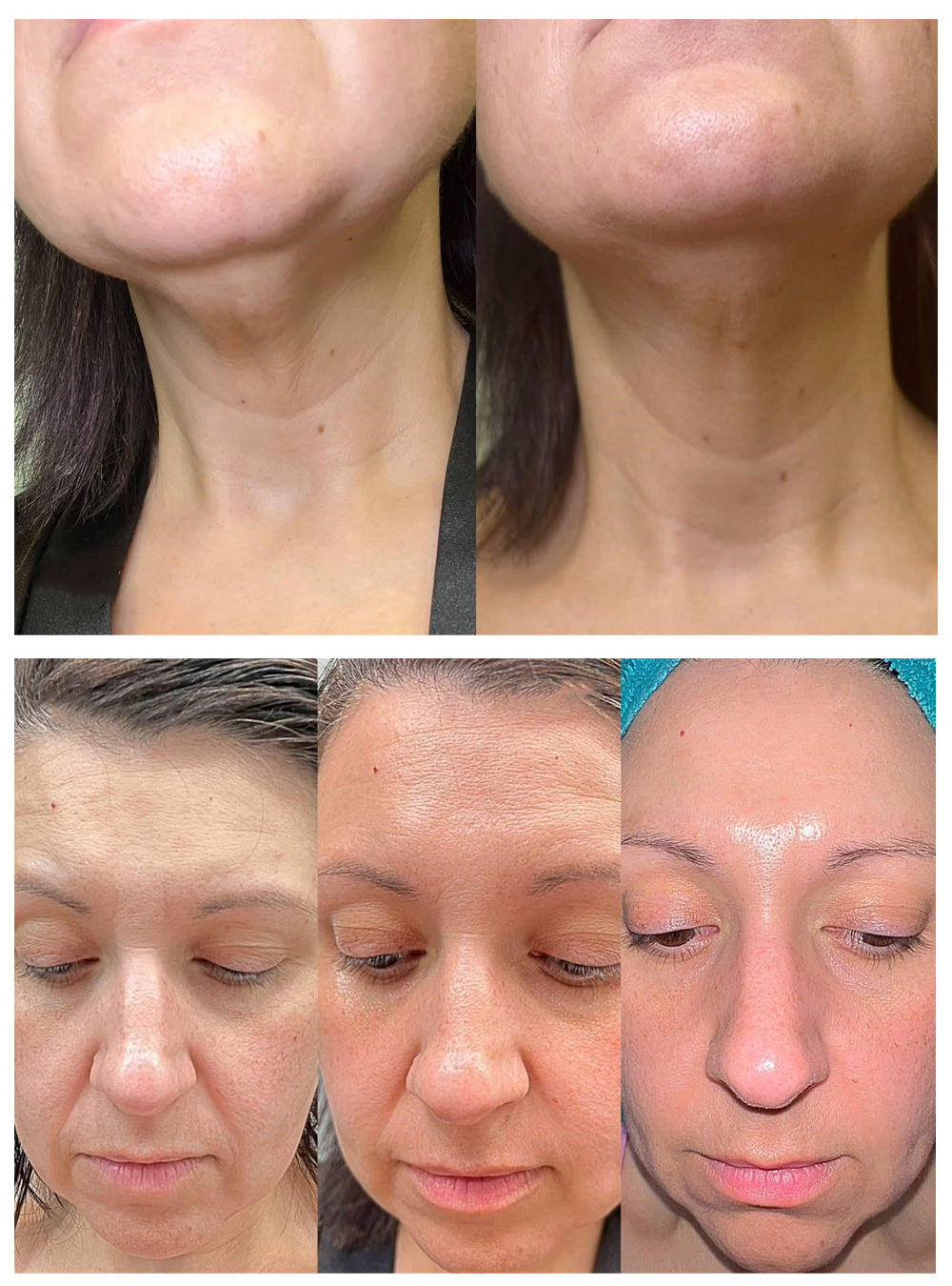 Cell Regen Growth Factor Serum