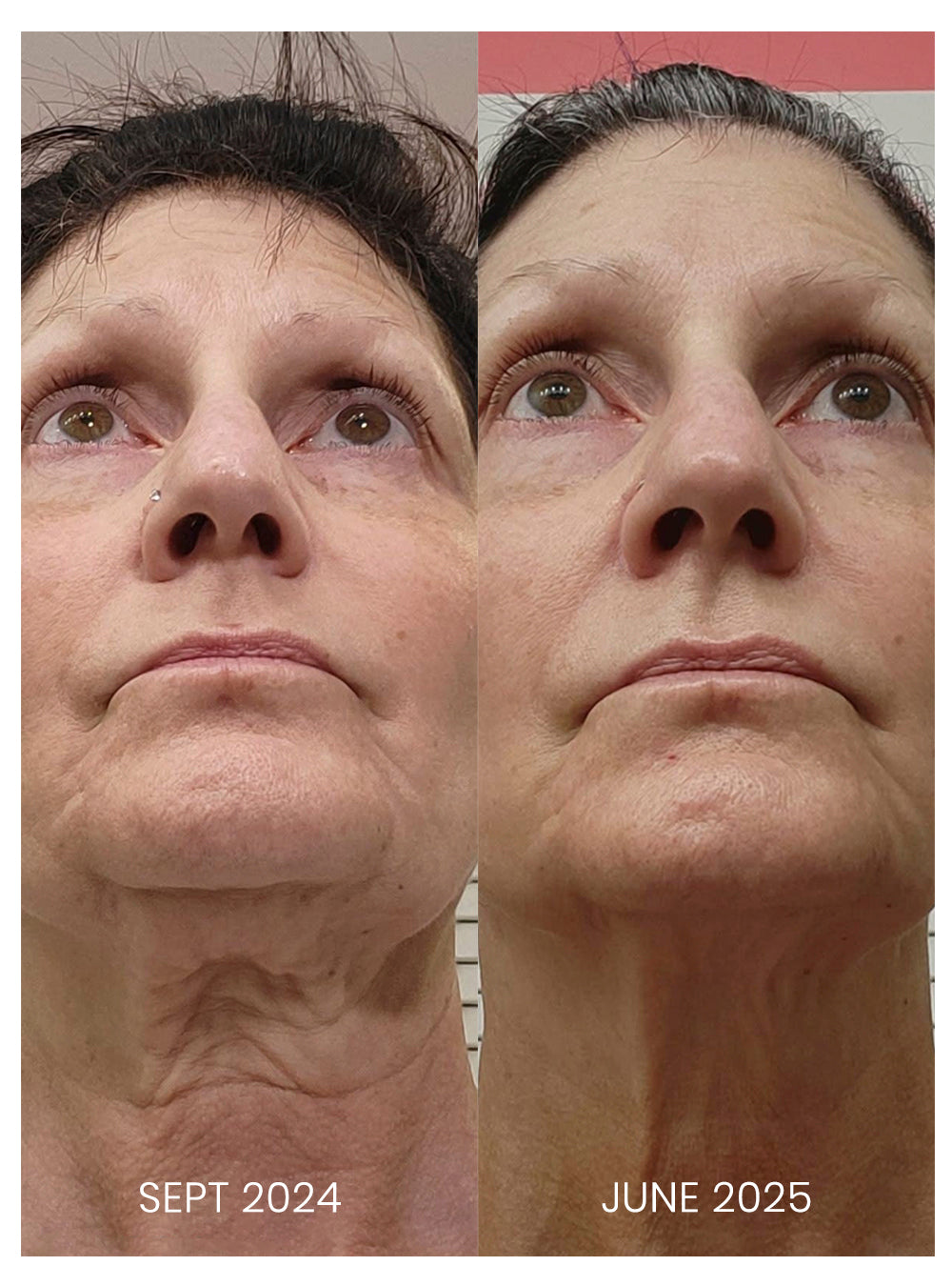 Cell Regen Growth Factor Serum