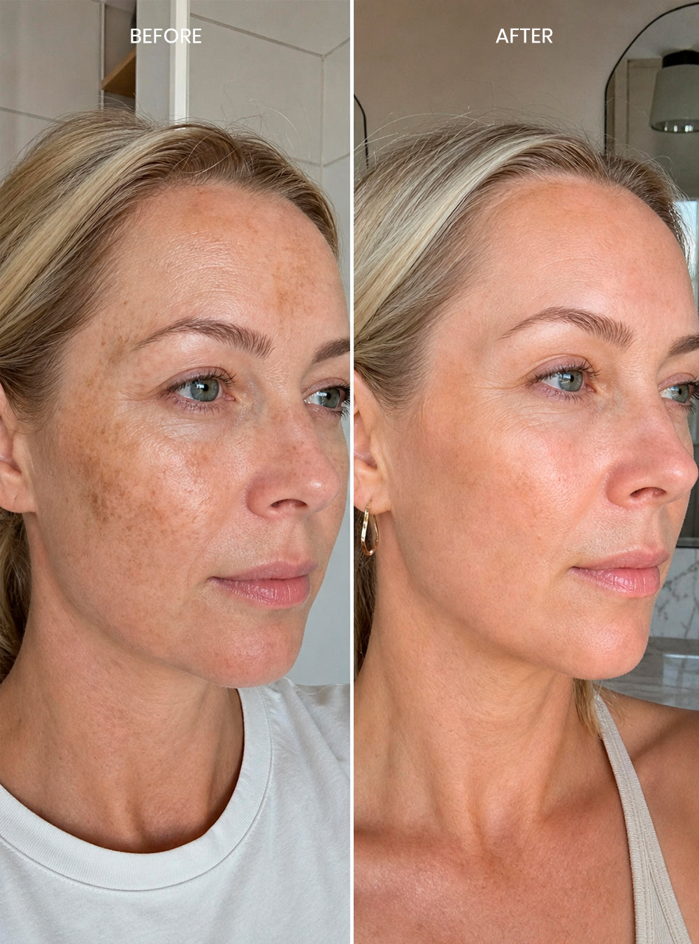 Dark Spot Correcting Cream