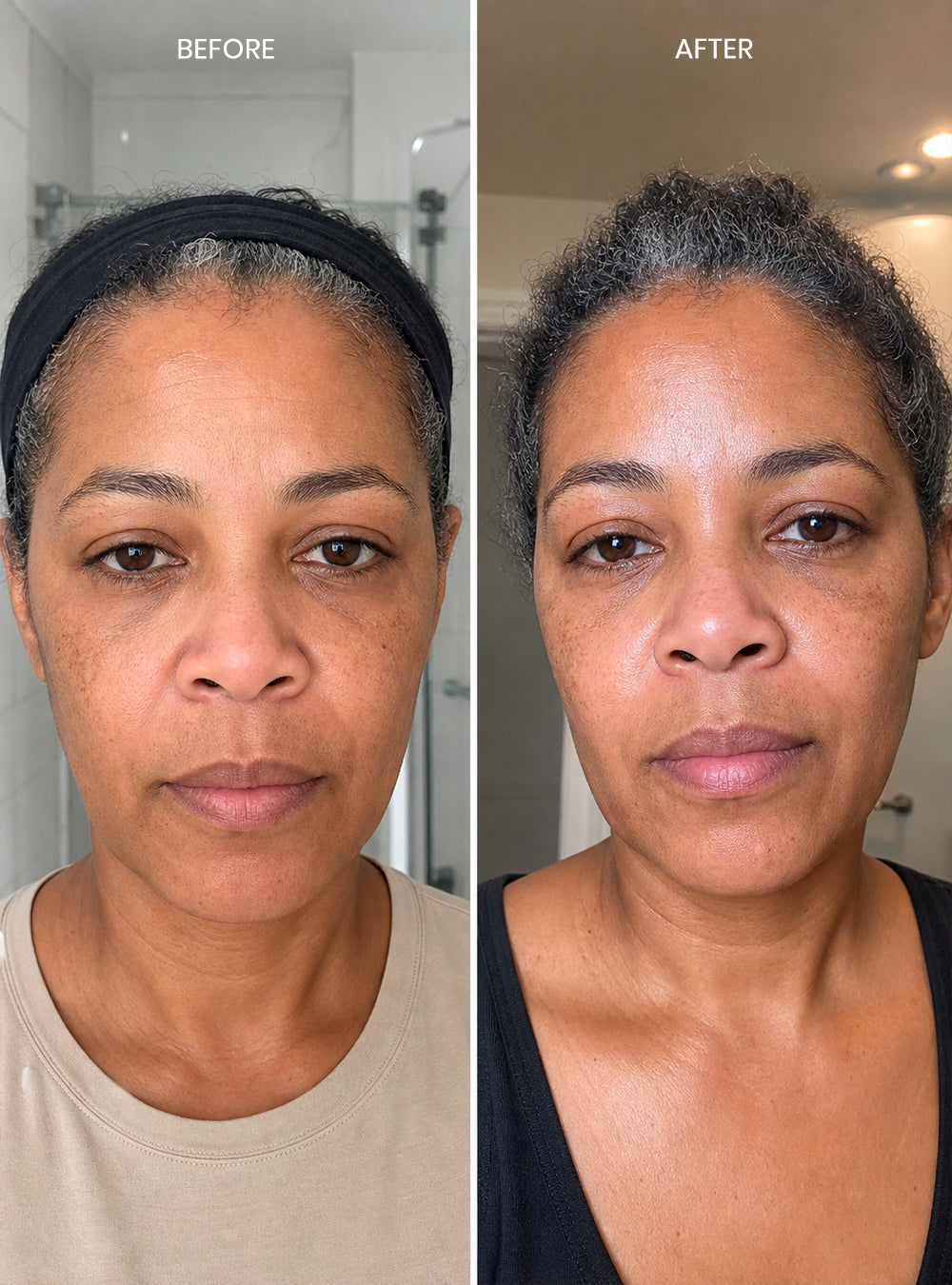 Ectoin Action Serum