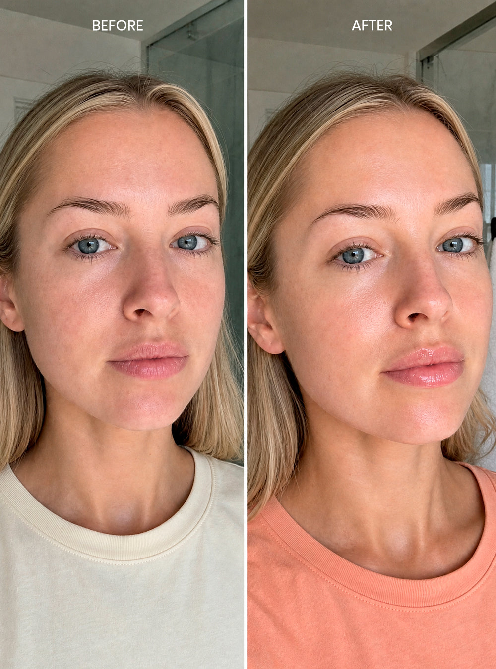Heal & Shine Lip Gloss