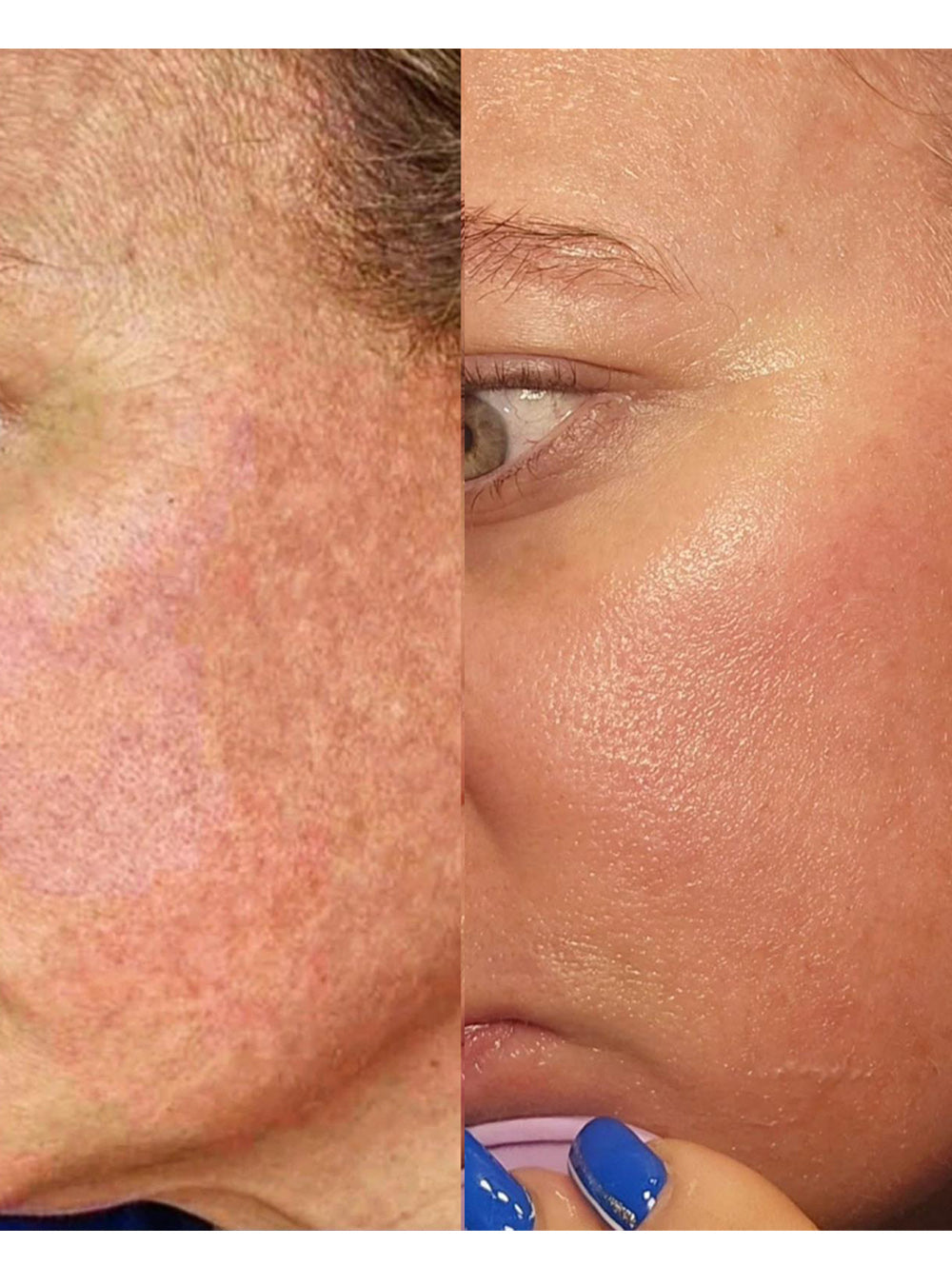 Retinol Repair Serum