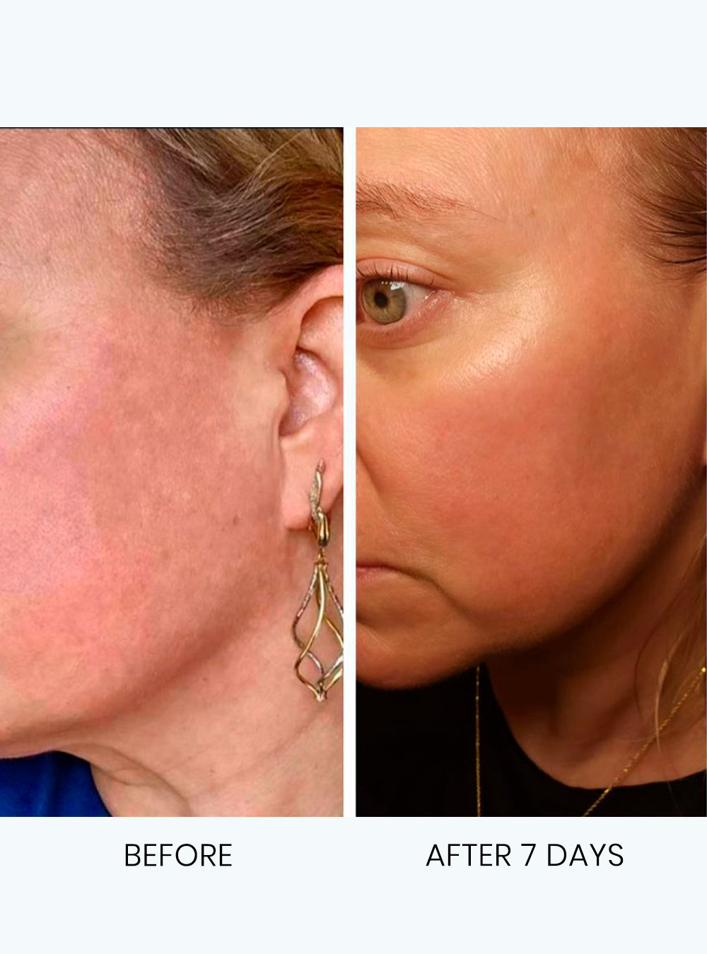 Ultra-Brightening Cleanser