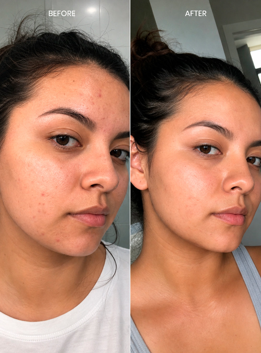 Instant Repair Mask
