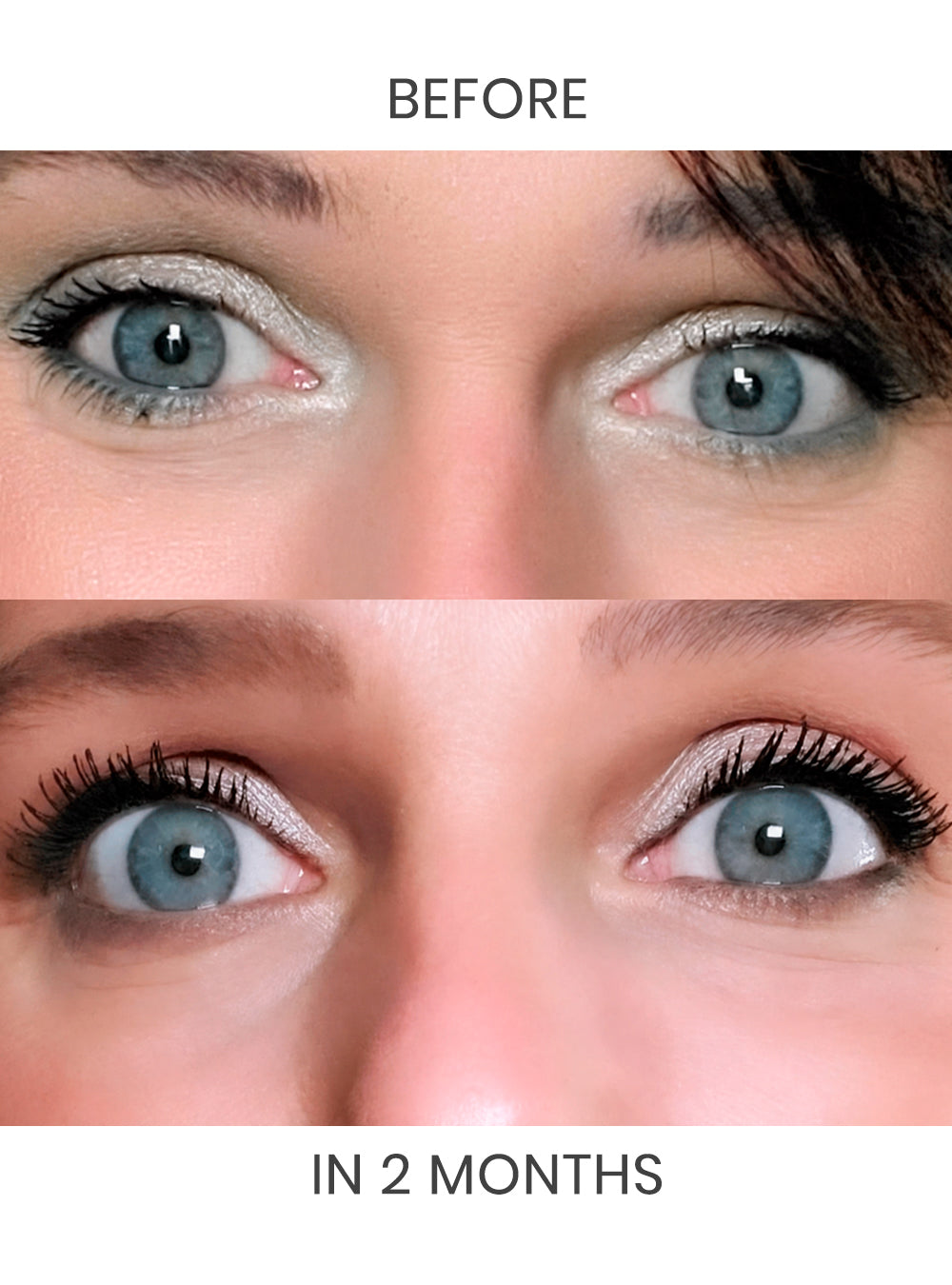 Infinite Growth Lash&Brow-Supports Fuller, Healthier Lash&Brow