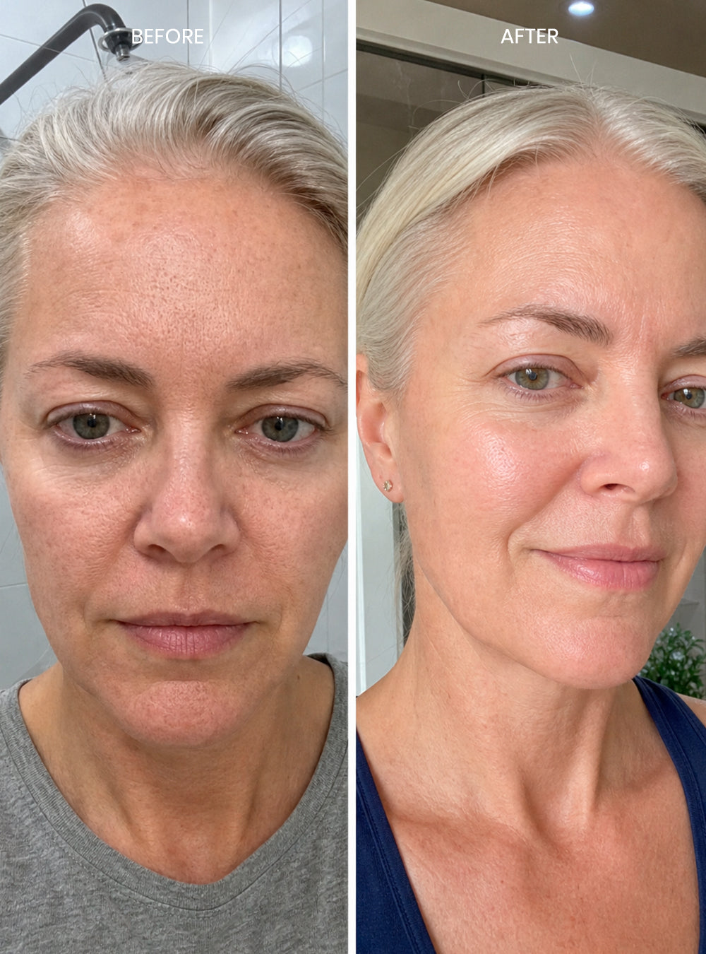Micro Exfoliate Purity Peel