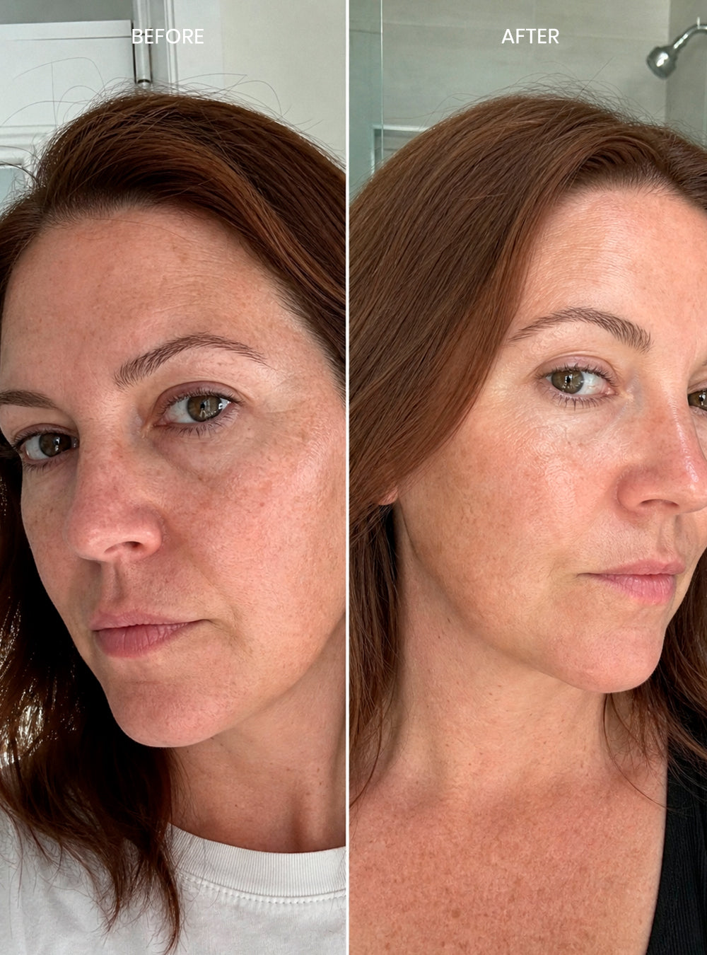 Micro Exfoliate Purity Peel