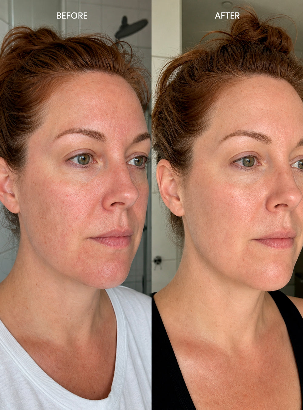 Miracle Toner