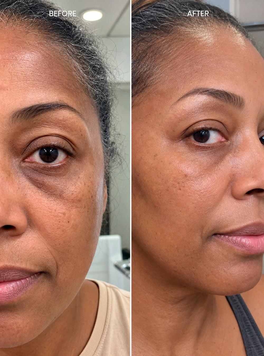 Multi-Peptide Eye Therapy