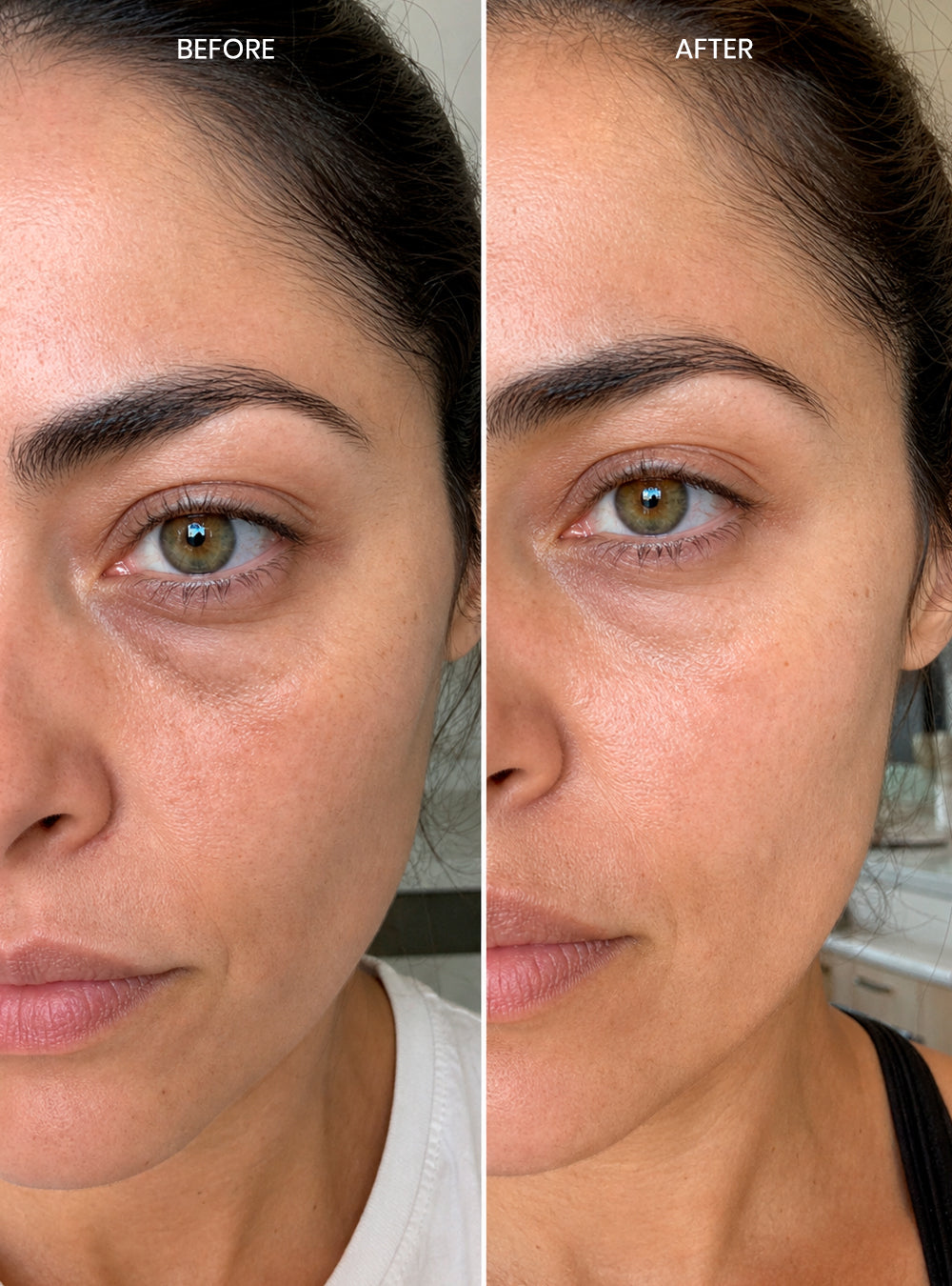 Multi-Peptide Eye Therapy