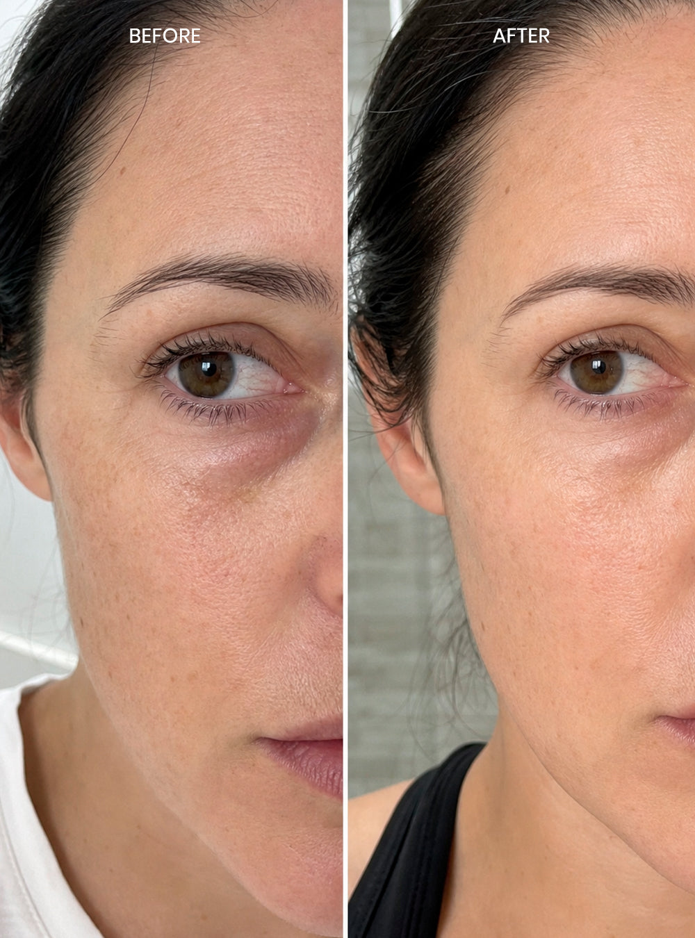Multi-Peptide Eye Therapy
