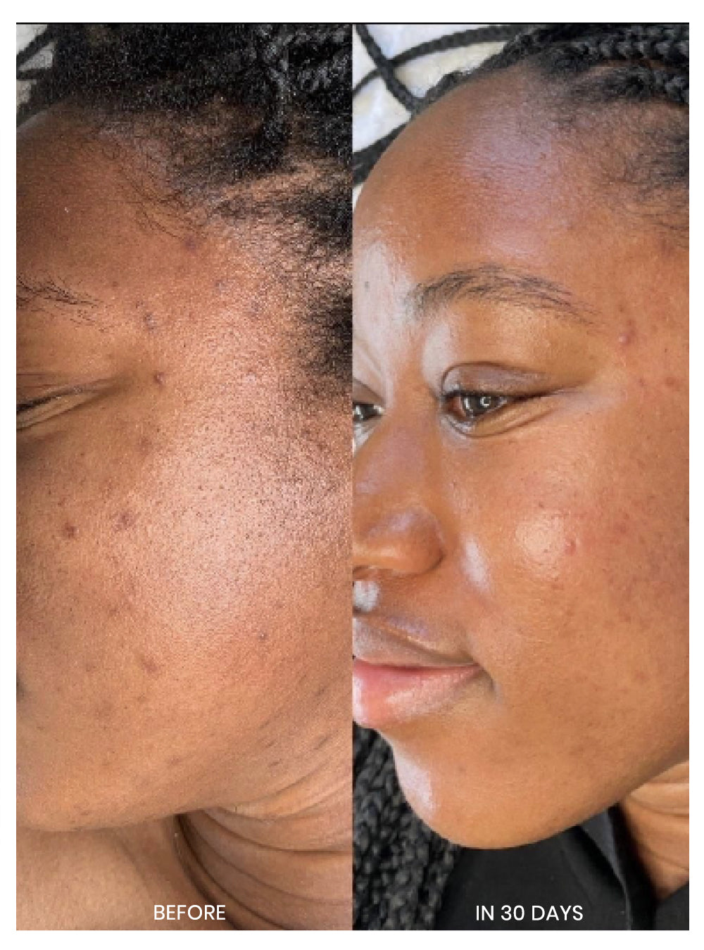 Retinage Daily Quick Mask