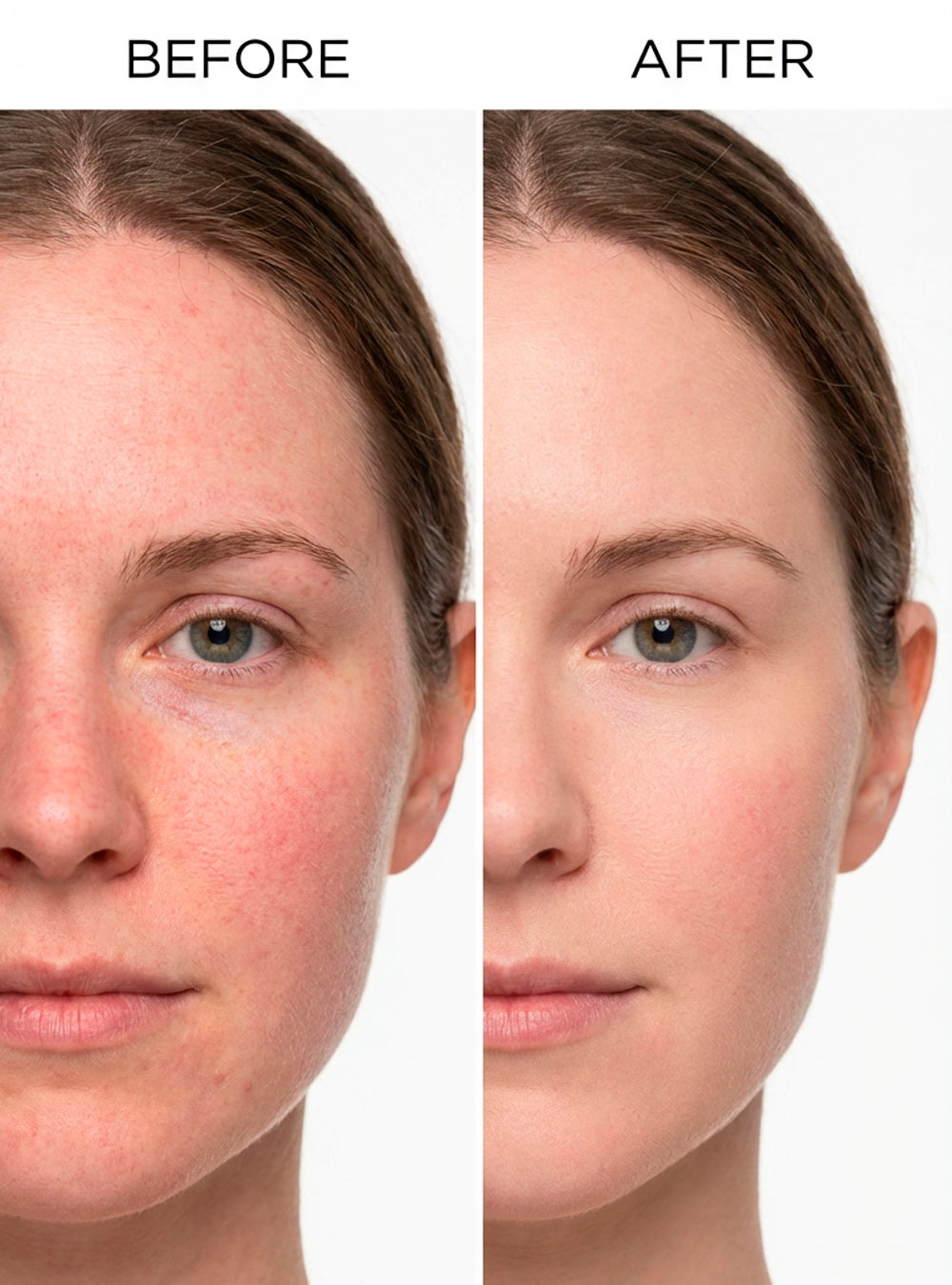 Gamme Peaux Sensibles