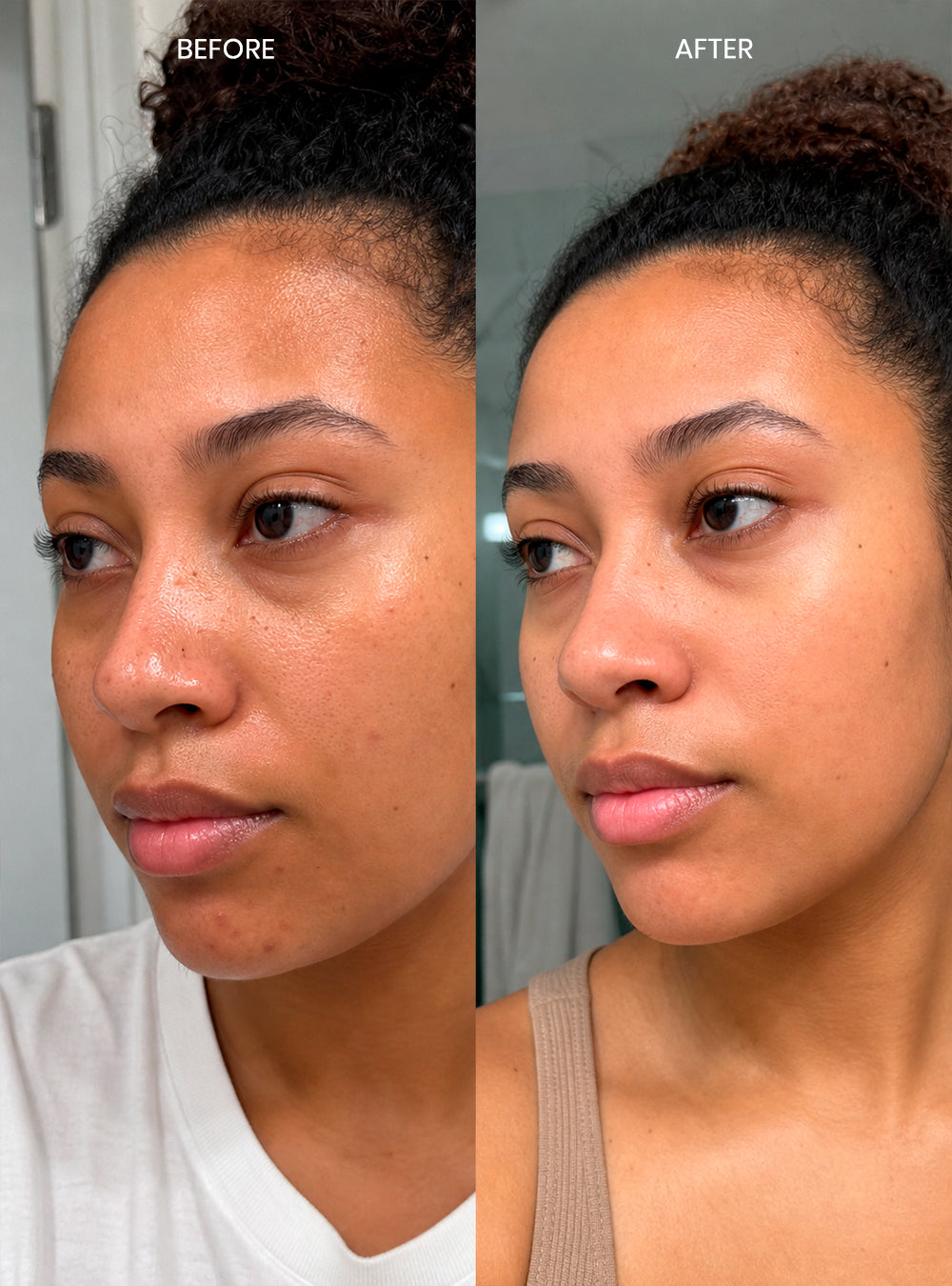 Clarifying Treatment Pads