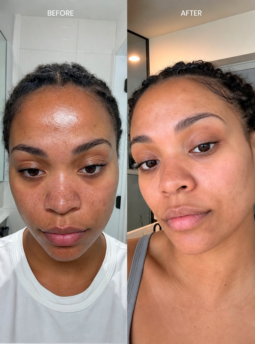 Clarifying Treatment Pads
