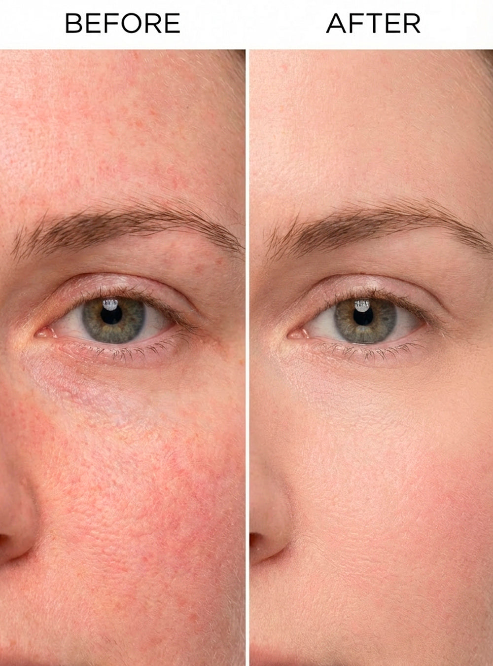 Ultra Soothing Serum